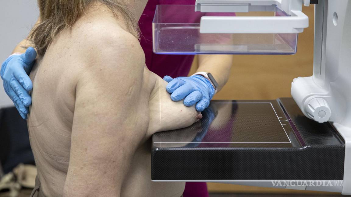 $!Una enfermera de la Asociación Contra el Cáncer realiza una mamografía a una mujer en la sede de la Asociación de Murcia, España.