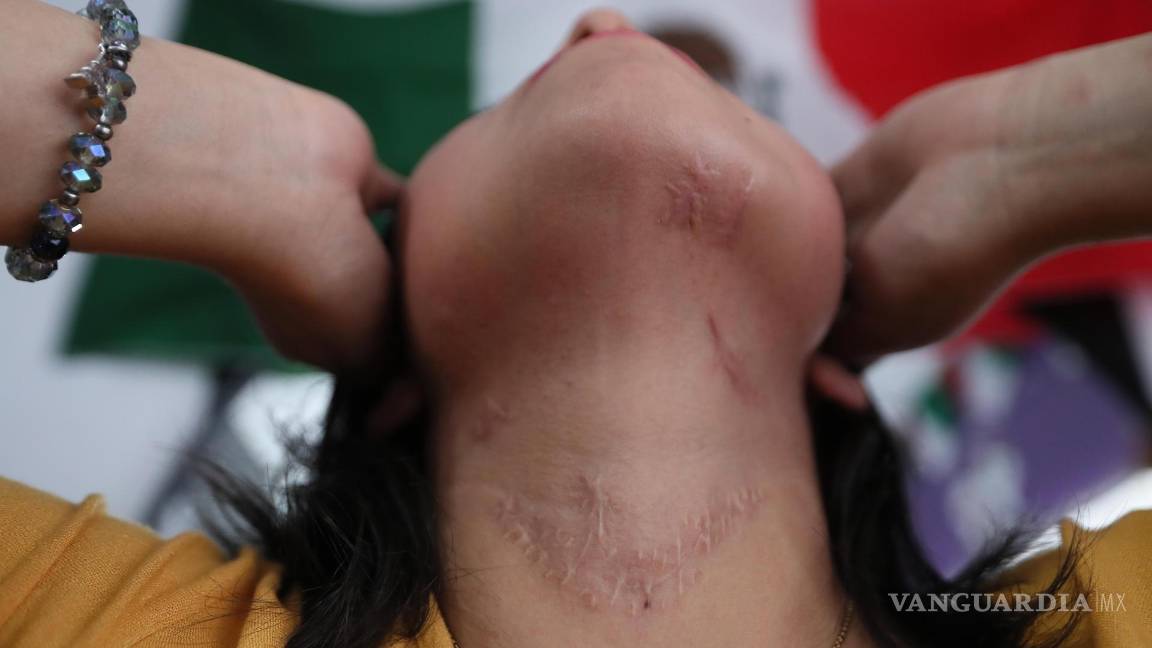 $!Ayyselet Gutiérrez fue víctima de intento de feminicidio. Su expareja le asestó 27 puñaladas que la llevaron a estar muy cerca de la muerte.