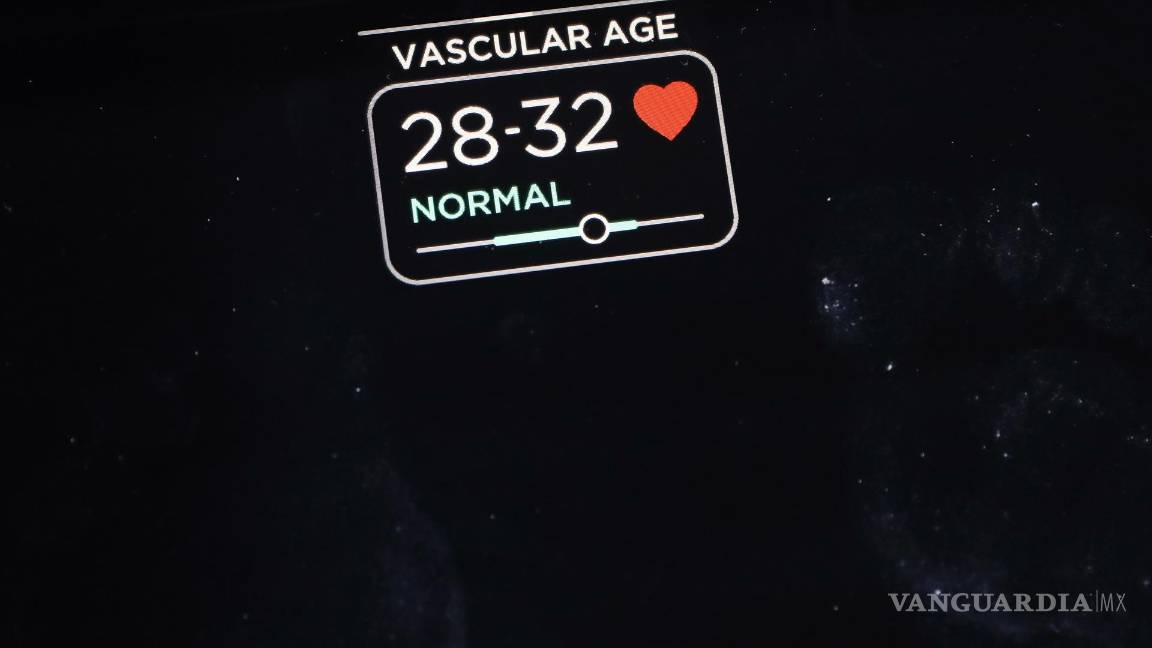 $!La báscula inteligente de Withings que incluye características como evaluación de nervios y mediciones de ECG. EFE/EPA/Caroline Brehman