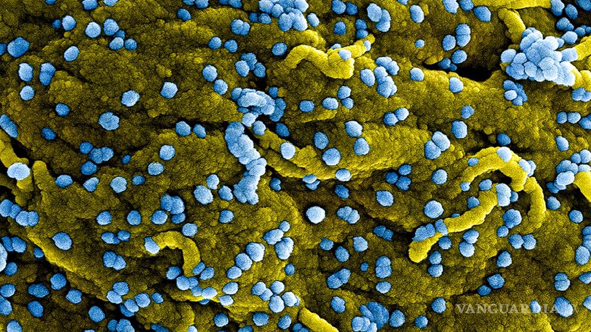 $!Se contagia de persona a persona por el contacto directo de los fluidos corporales de los infectados, o con superficies o materiales