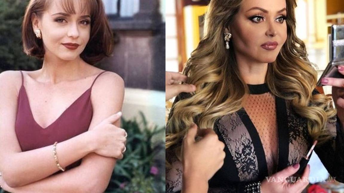 $!No solo es la Guzmán; estas celebridades quedaron peor con sus cirugías