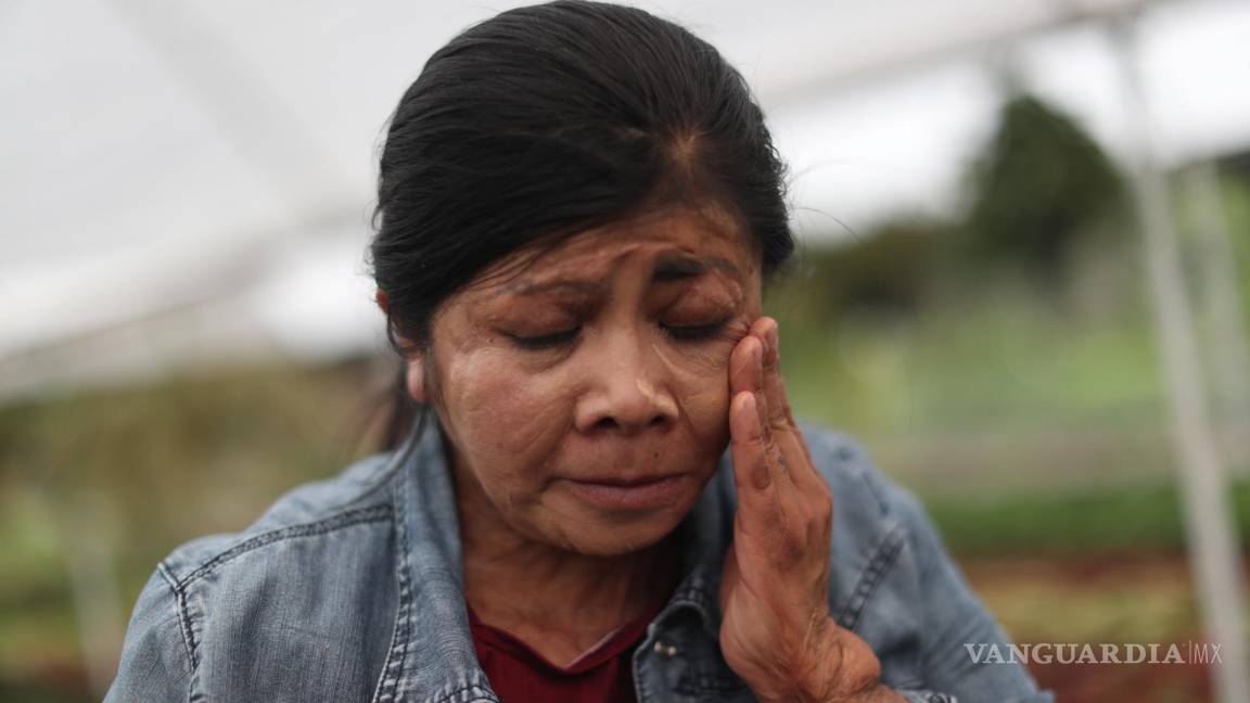 $!Elisa Xolalpa, mujer sobreviviente de ataque con ácido por su entonces pareja Ciudad de México (México).