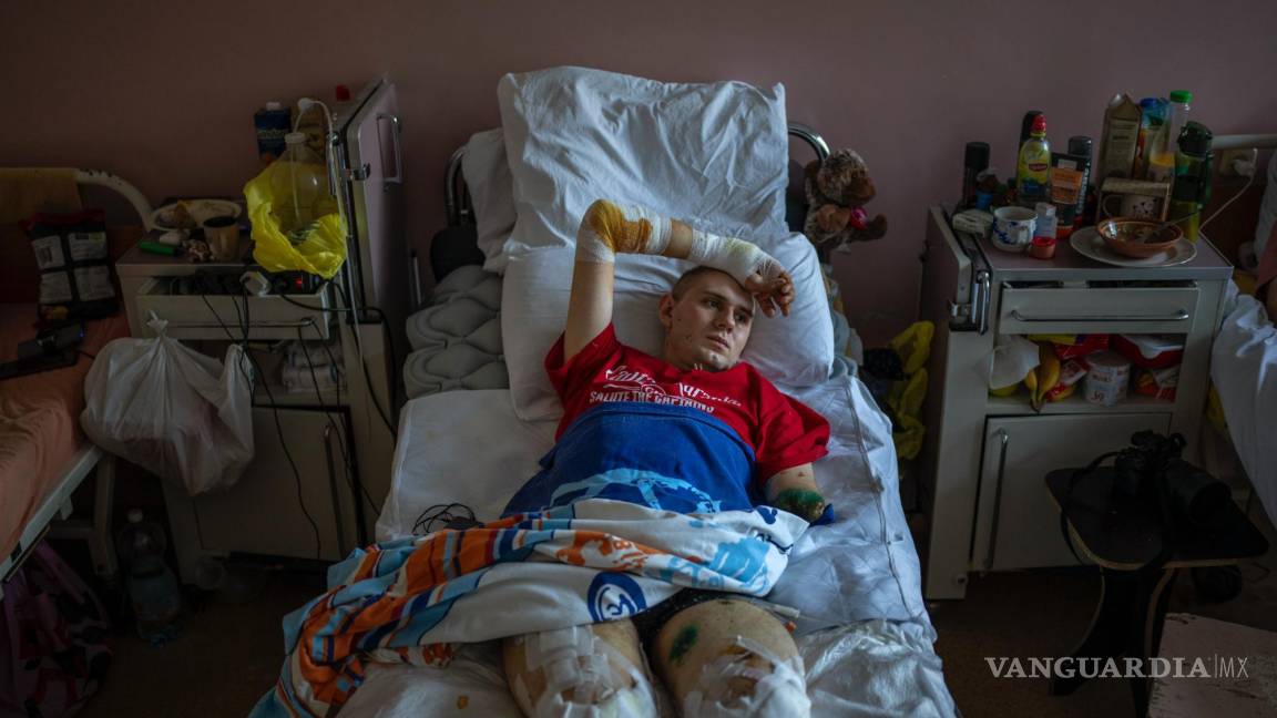 $!Anton Gladun médico militar de 22 años perdió las dos piernas y un brazo en la explosión de una mina el 27 de marzo.