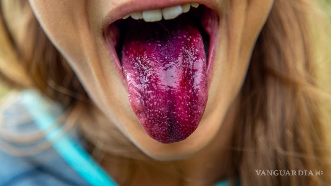 $!La acumulación en la lengua huele mal porque allí pueden vivir colonias bacterianas.