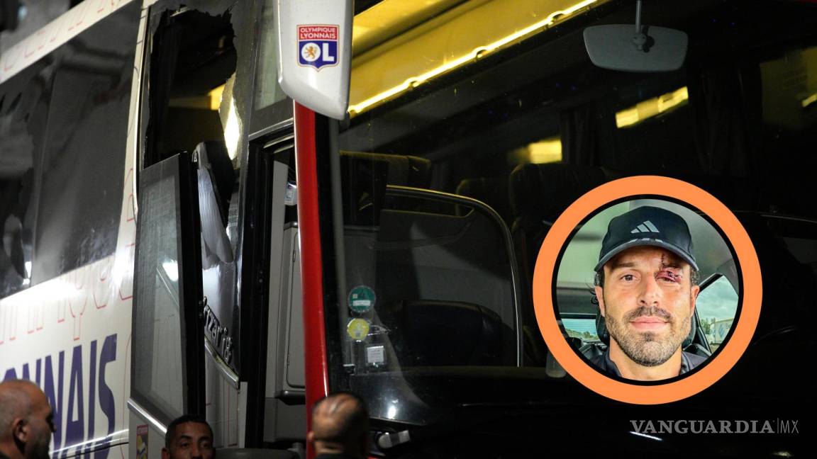 Detienen a nueve personas tras agresión a autobús del Lyon donde salió herido el DT Fabio Grosso