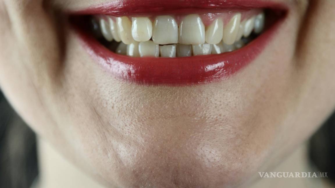 $!Tener una sonrisa blanca y radiante es el deseo de muchos.