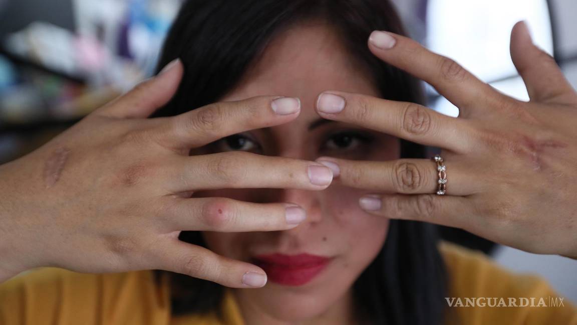 $!“Yo ya no quiero ni puedo seguir escondiéndome”, dijo Ayyselet Gutiérrez en una entrevista en Ciudad de México (México).