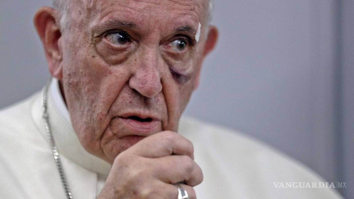 “La ONU tiene que hacerse oír y ayudar en Venezuela”: Papa Francisco