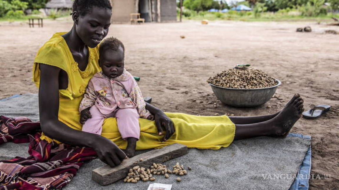 Desnutrición aguda se dispara en más de 20 países, pronostican la FAO y el PMA