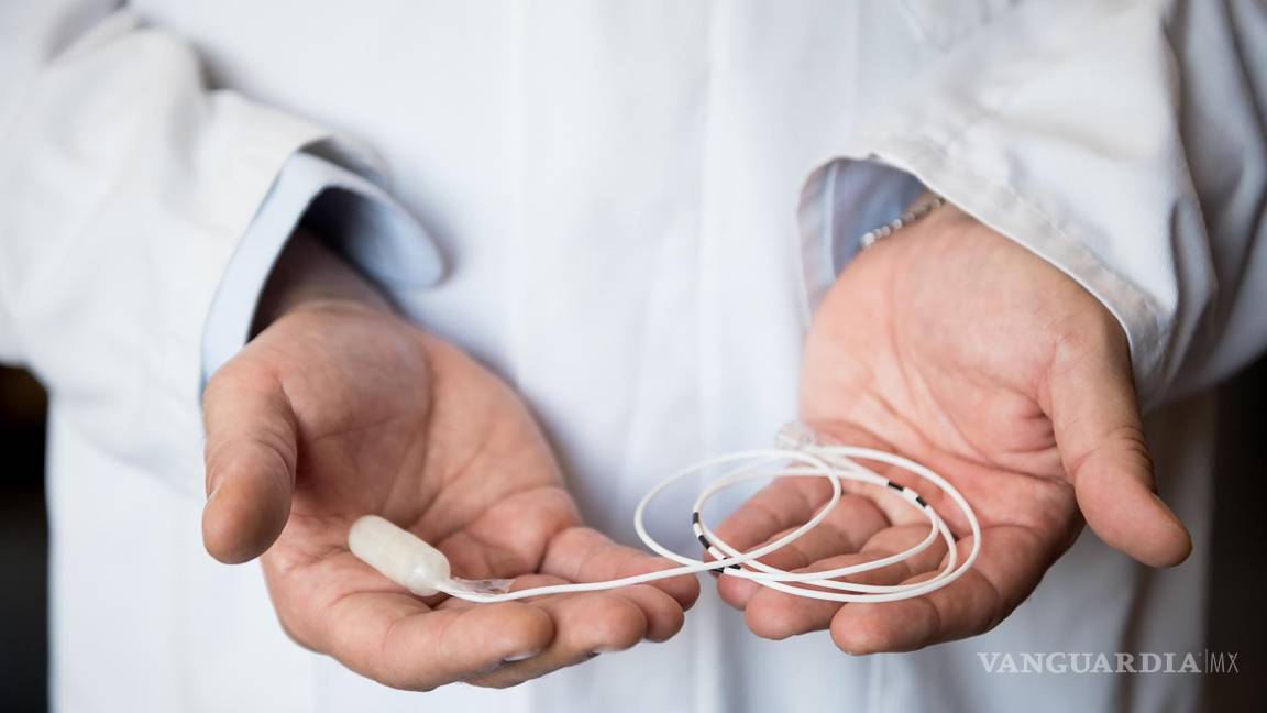 $!Cápsula con balón plegado en su interior y catéter de llenado.