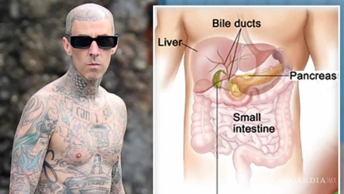 ¿Qué es la pancreatitis? Te explicamos el ‘dolor extremo de estomago’ de Travis Barker