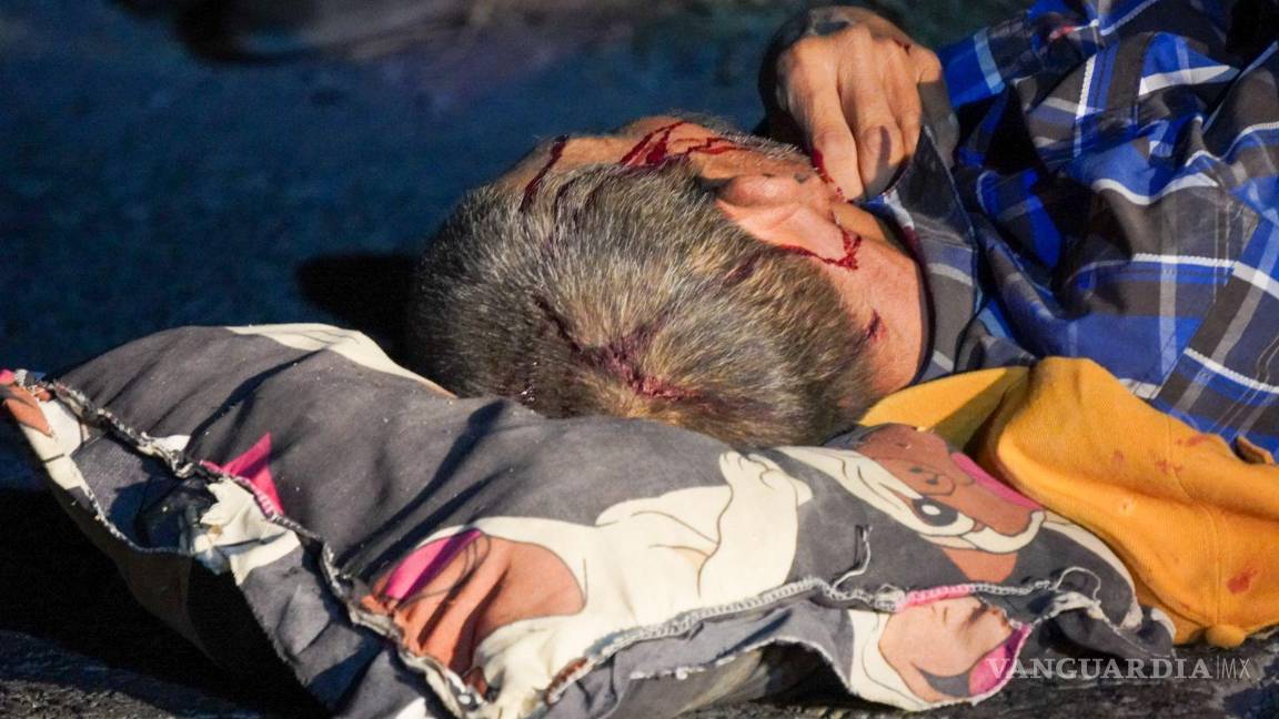 $!20 personas resultaron heridas.