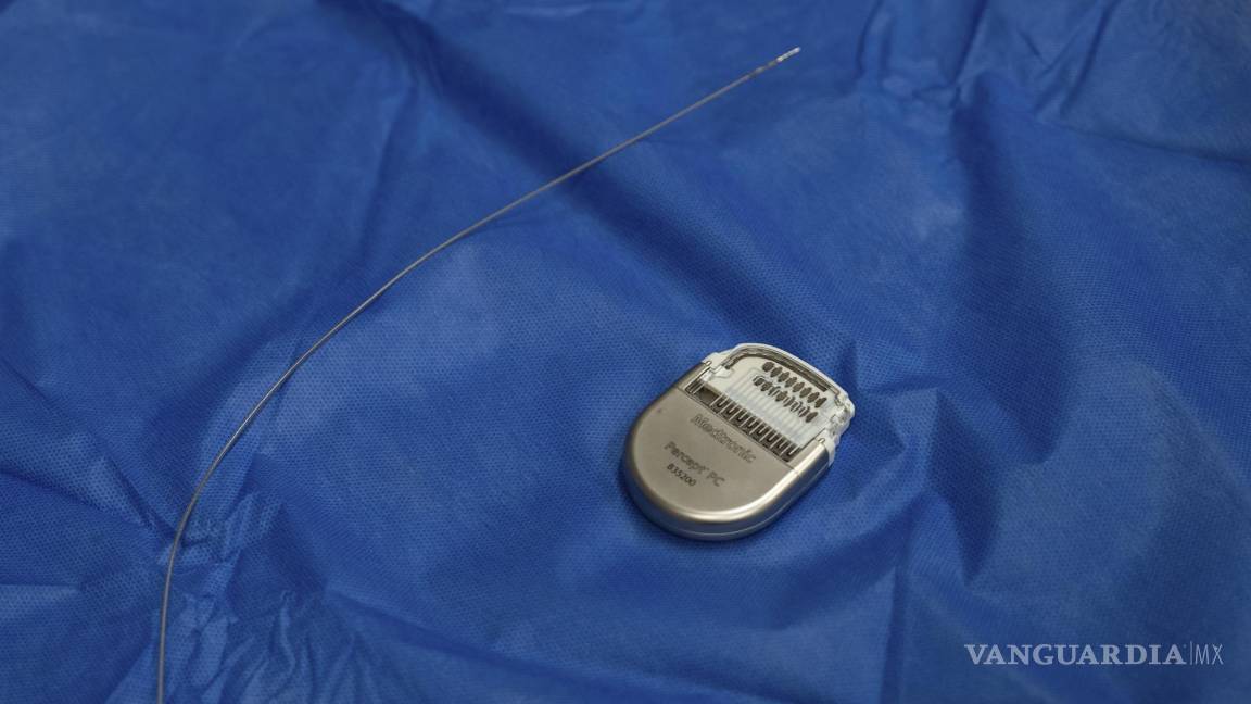 $!Una muestra de un dispositivo similar a un marcapasos, utilizado para la terapia de estimulación cerebral profunda.