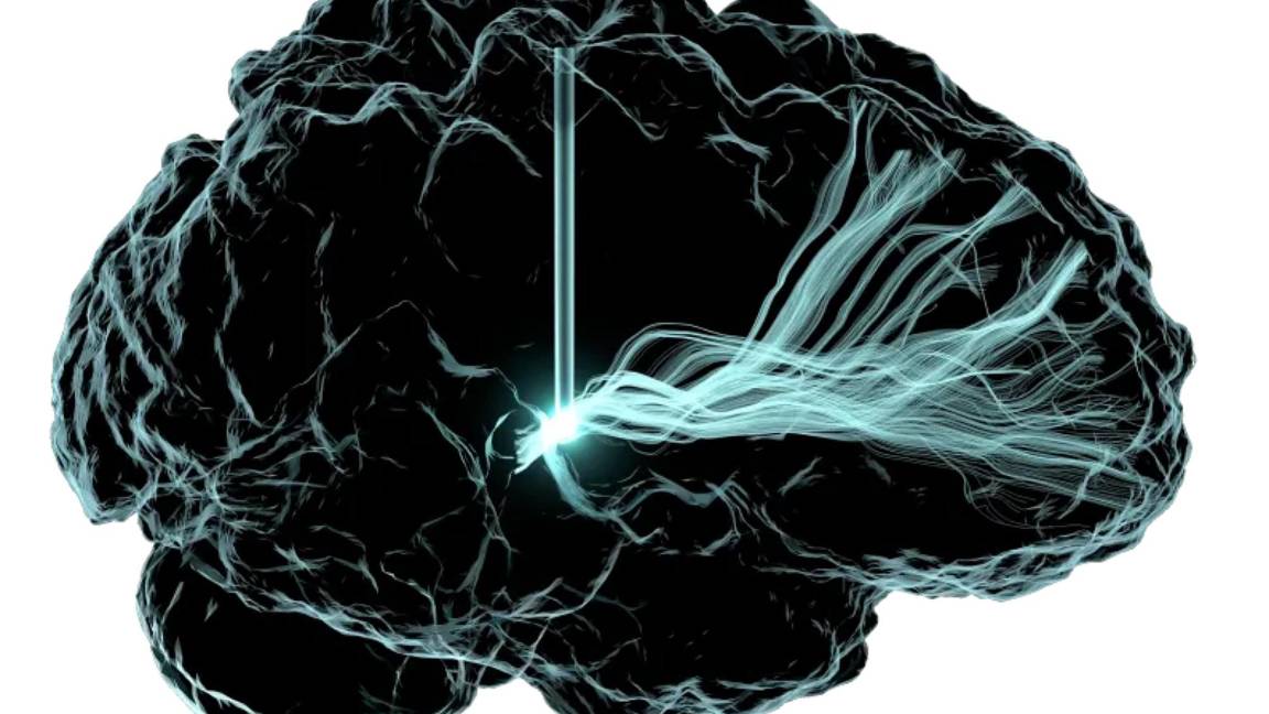 $!Como resultado de un total de 21 estudios de investigación, mismos que conforman el atlas celular del cerebro.
