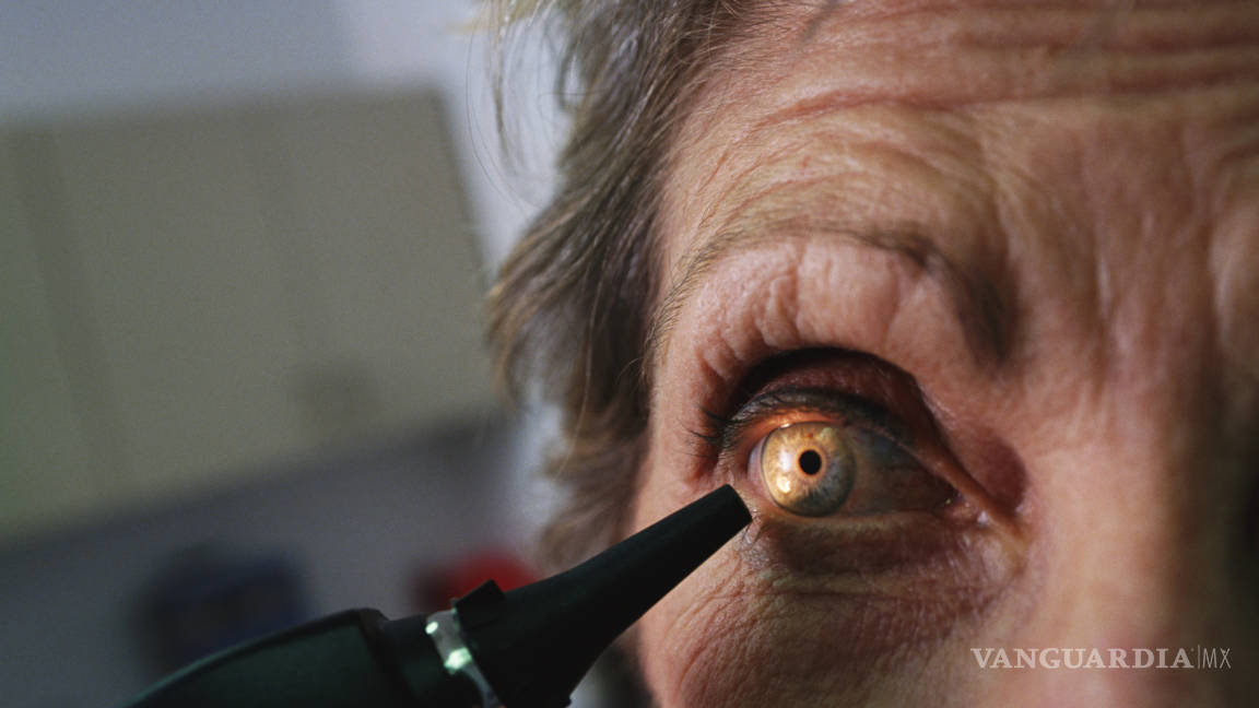 IMSS atiende glaucoma, principal causa de ceguera irreversible
