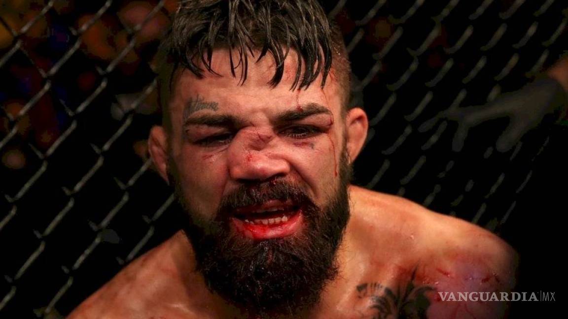 Así quedó la nariz de un peleador de la UFC (foto)