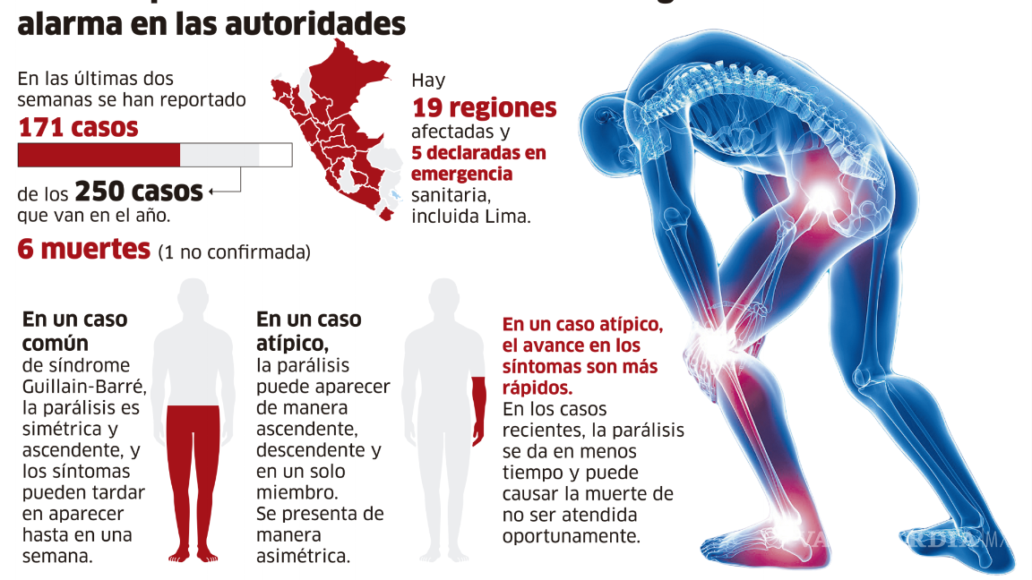 $!Guillain-Barré, ¿qué es este síndrome que tiene a Perú en emergencia sanitaria?
