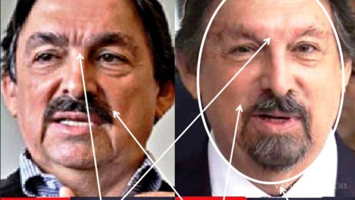 Sugiere experto en cirugía plástica que Napoleón Gómez Urrutia recurrió a tratamientos cosméticos como el botox