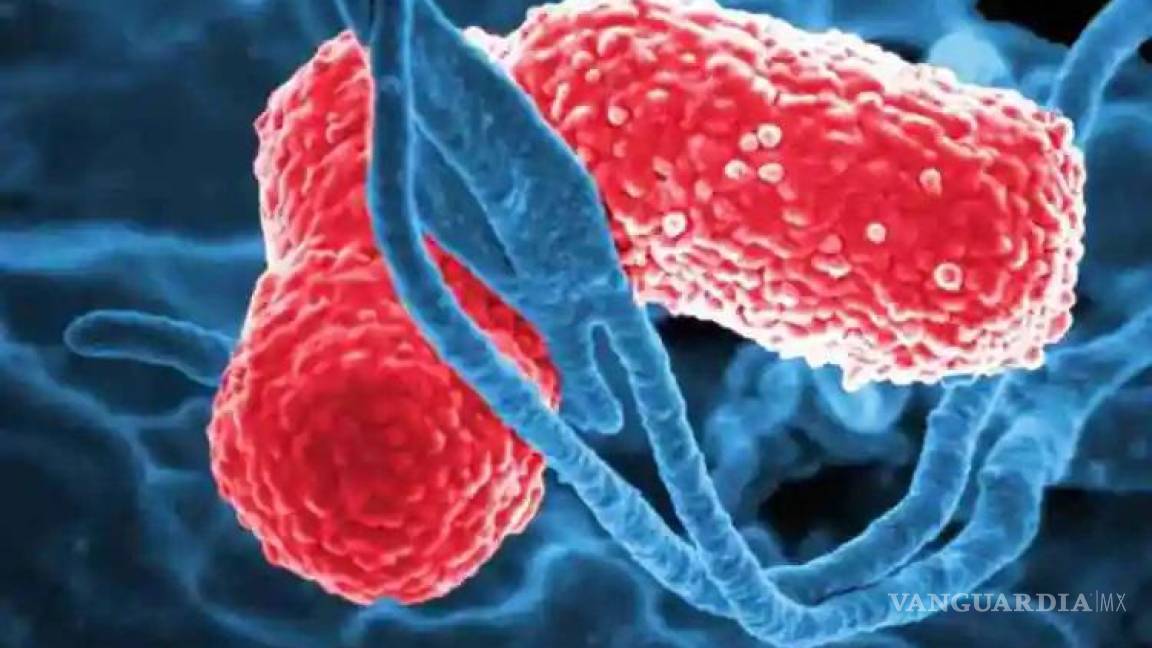 Brote de Klebsiella oxytoca está ‘bajo control’, asegura Salud del Edomex