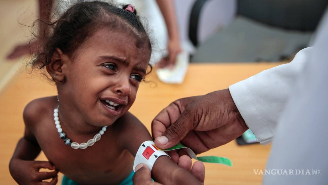 $!Según Save the Children, el hambre habría matado a 85 mil niños en Yemen