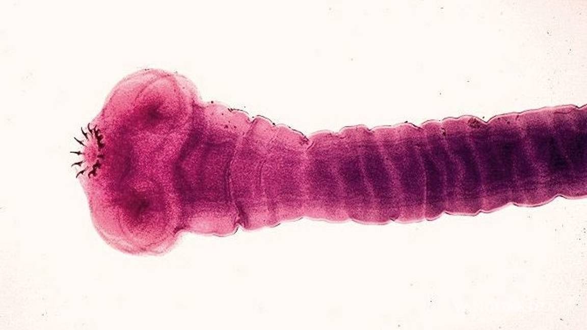 $!Un insecto le comía el cerebro desde hace 15 años