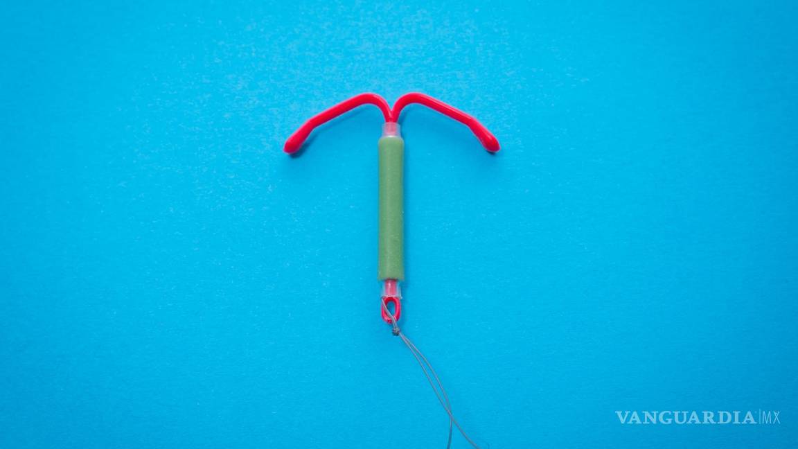 $!Introducir el dispositivo en forma de T en el útero significa que este primero tiene que abrirse paso a través del cuello uterino.