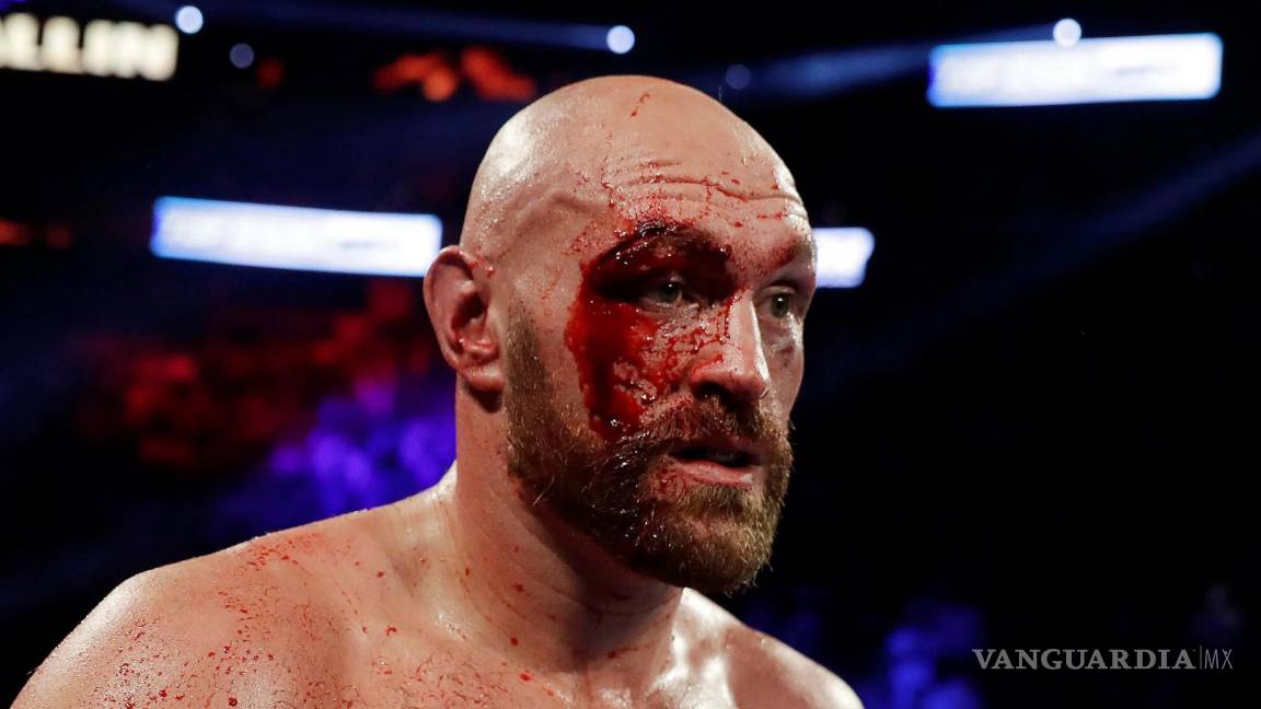 Tyson Fury vs Oleksandr Usyk: se cancela pelea del 17 de febrero por una lesión de ‘Gipsy King’