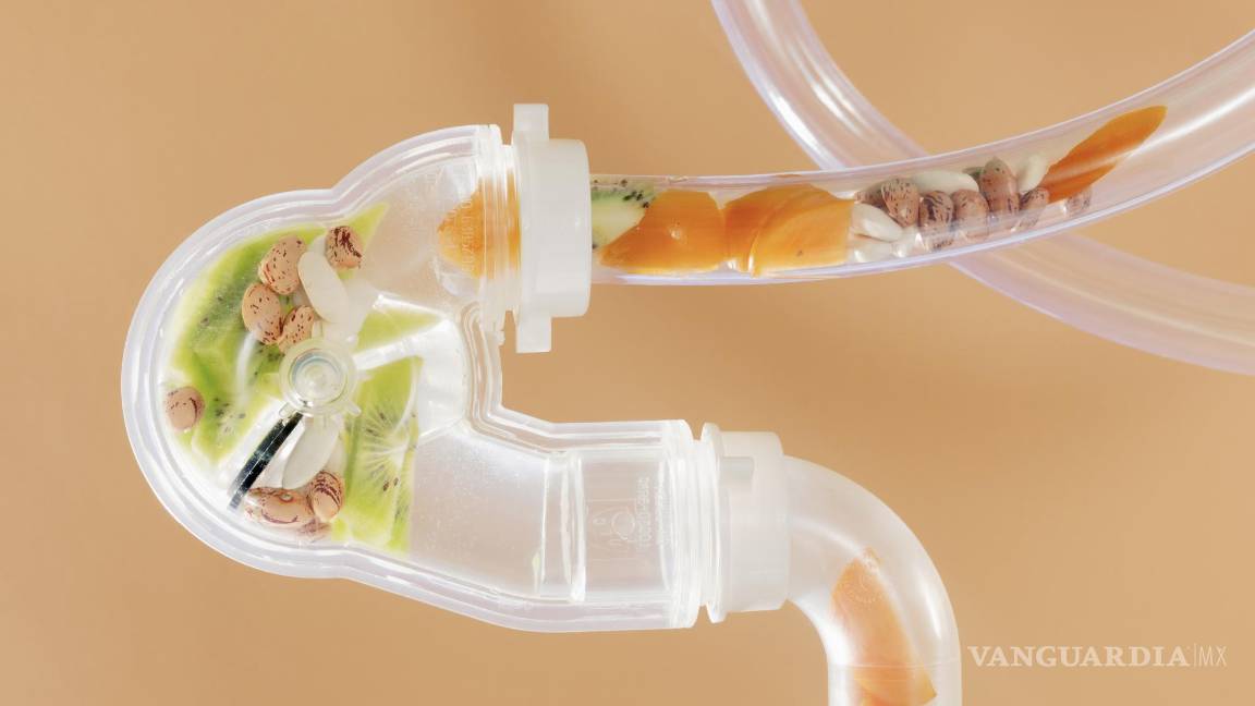 $!Más del 20 por ciento de las personas con estreñimiento crónico padecen una disfunción de los músculos del suelo pélvico.