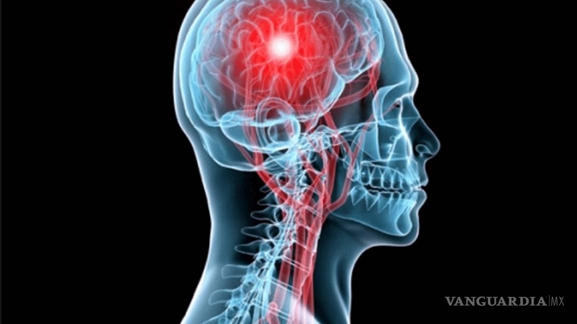 $!Siete pasos para evitar un derrame cerebral