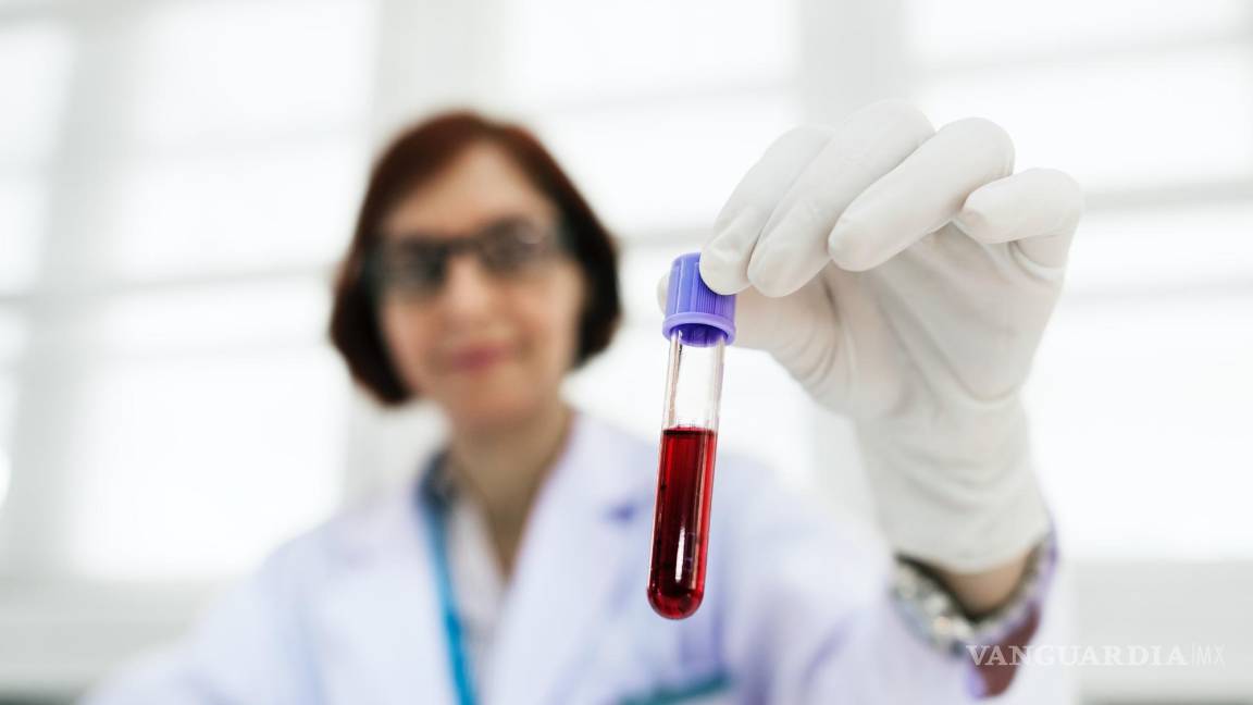 $!Aproximadamente el 85 % de las personas son Rh positivas, el 15 %, negativas, y apenas unas cuantas son Rhnull.