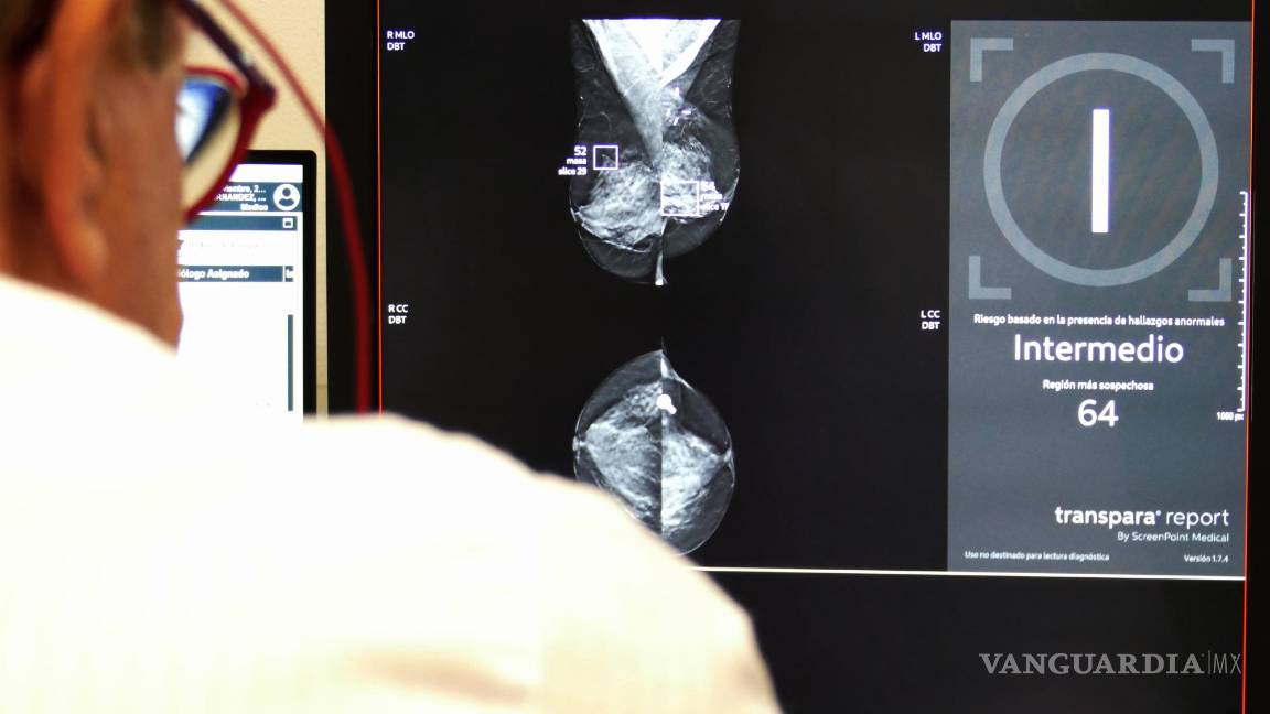 $!Imagen de la estadificación de riesgo de una mamografía a través de IA (mensaje a la derecha), en esta se marca la masa sospechosa encuadradas en violeta.