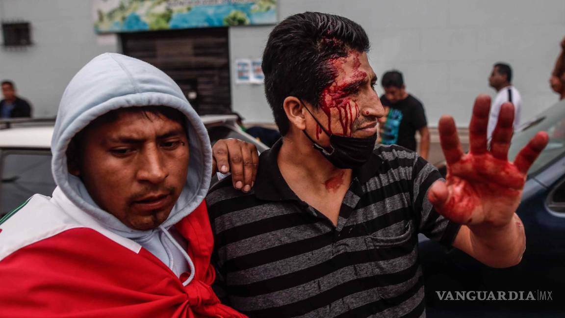 $!Un hombre herido permanece afuera de la Prefectura de Lima, donde permanece detenido el ahora expresidente Pedro Castillo.
