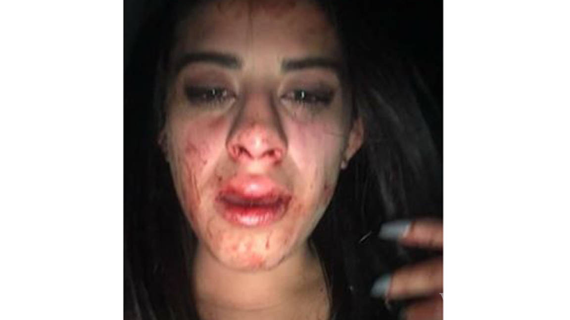 Denuncia mujer, fuerte agresión de hijo de conductor de Televisa Saltillo