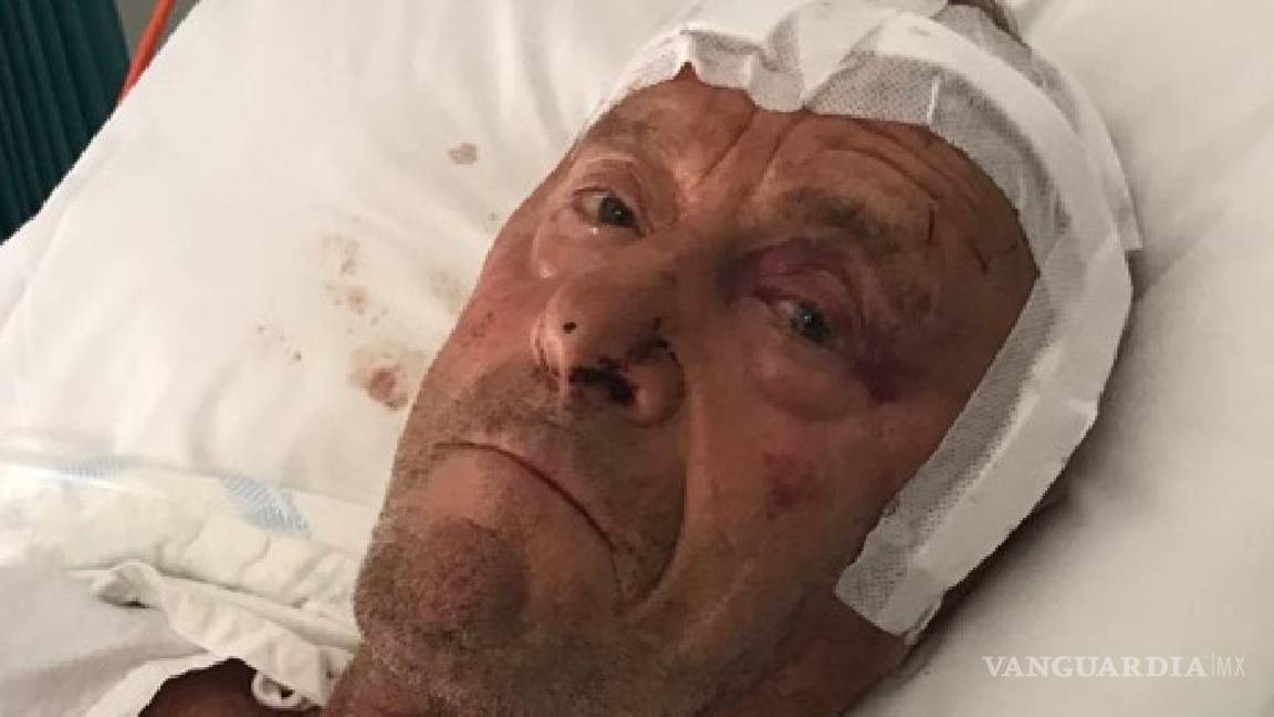 $!Apalean a un anciano por intentar frustrar un robo, le fracturaron el cráneo