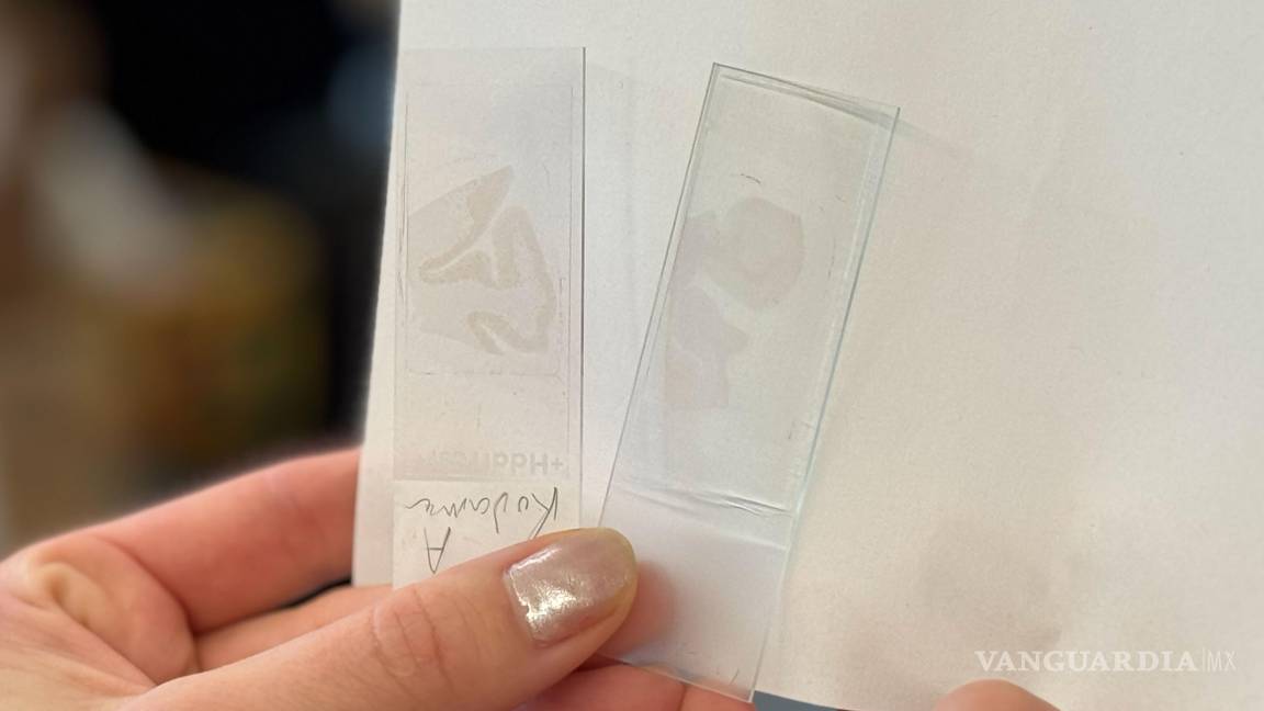 $!En la diapositiva de la izquierda, que contiene tejido cerebral con Alzheimer sin tratamiento. La de la derecha, que contiene tejido cerebral tratado con fármacos.