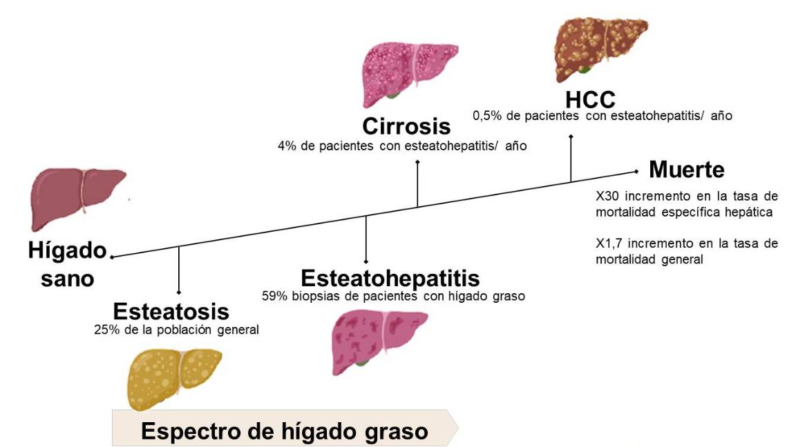 $!Gráfica cedida por el equipo de investigadores del CIMUS sobre la progresión de la fibrosis hepática.