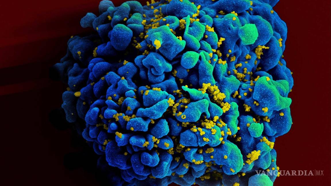 Es posible que una mujer se haya curado del VIH sin tratamiento médico