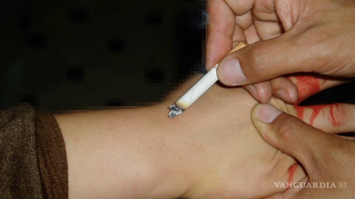 Atiende Pronnif de Coahuila a niños quemados con cigarillos