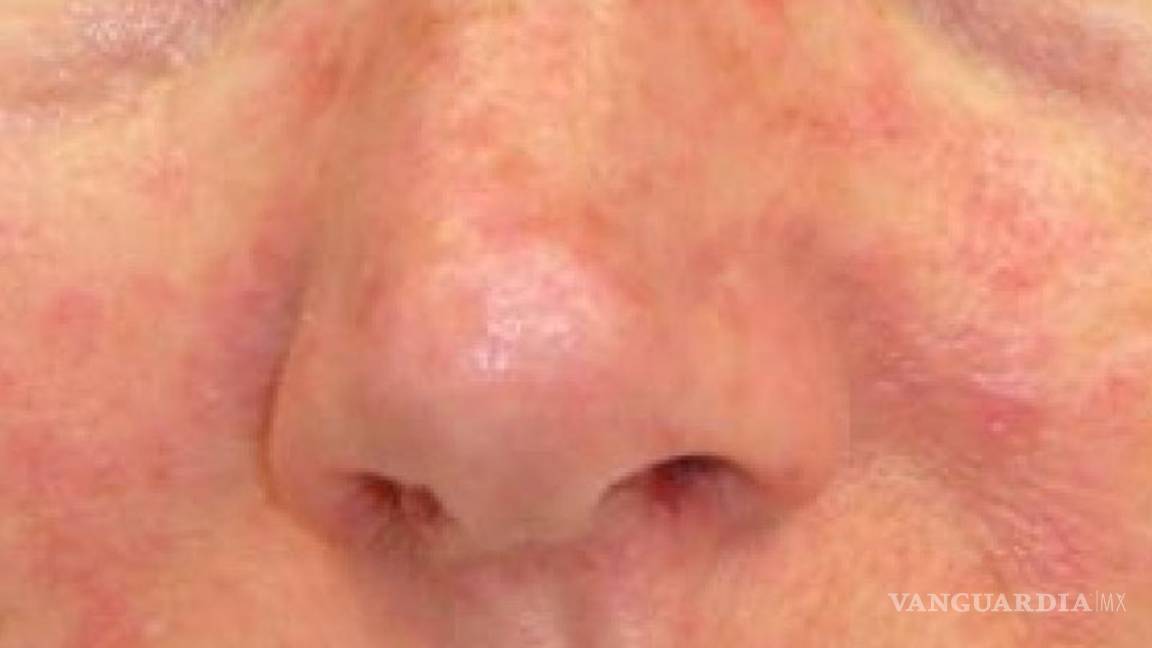 $!El zika se volverá endémico en América Latina: científicos