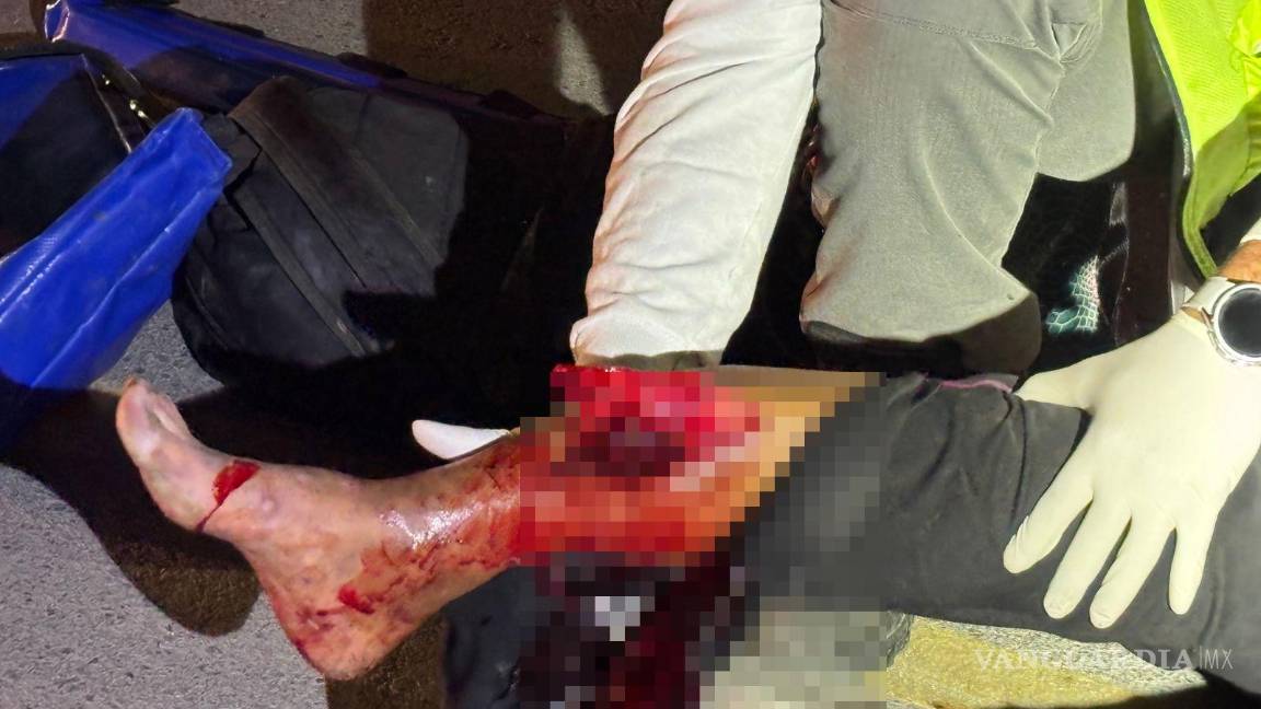 $!La mujer sufrió una fractura expuesta en la pierna derecha a causa del impacto del vehículo.