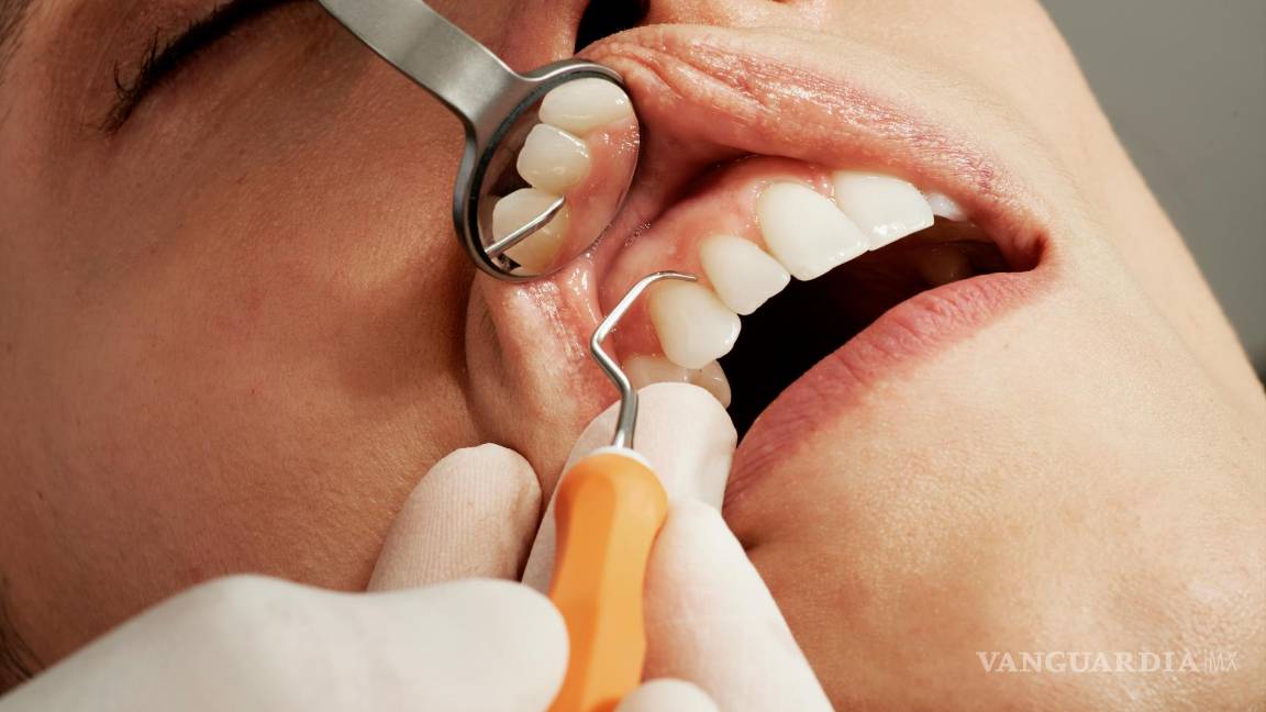 $!Visita a tu dentista regularmente para revisiones y limpiezas profesionales.