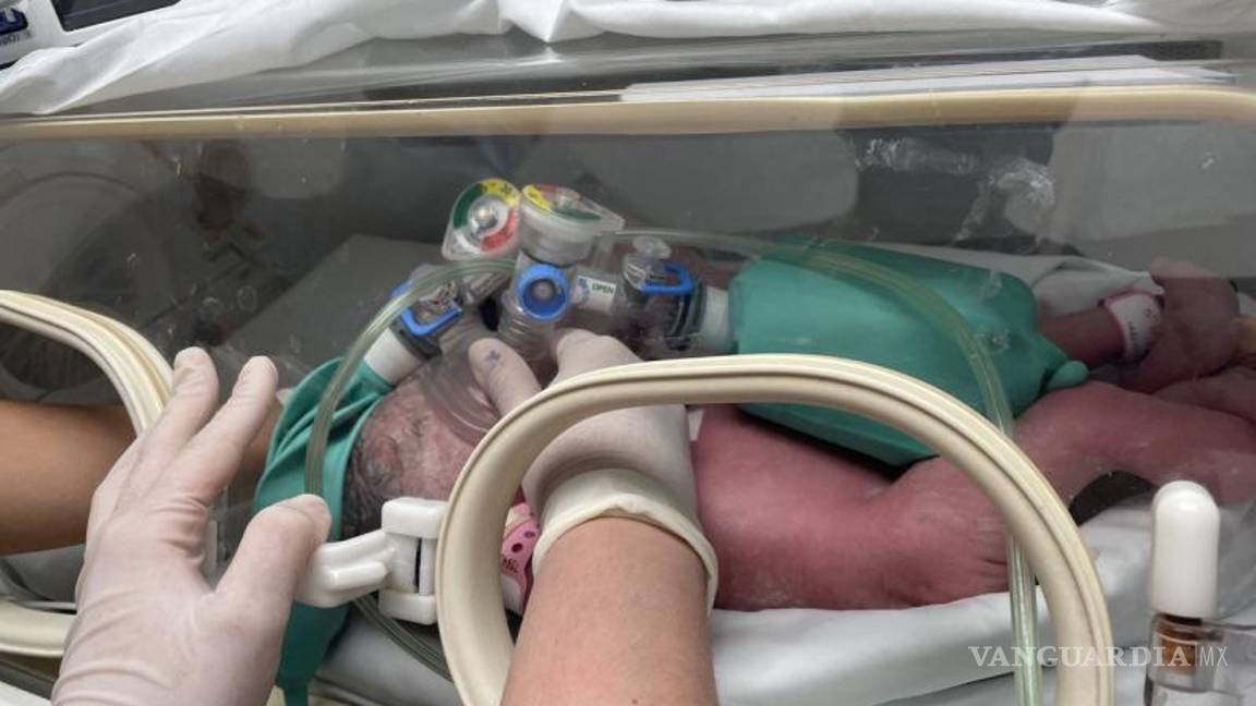 $!Las bebés, nacidas por cesárea, reciben atención médica en el área de cuidados intensivos del hospital.
