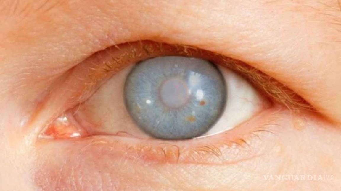 IMSS otorga más de 600 mil consultas por glaucoma