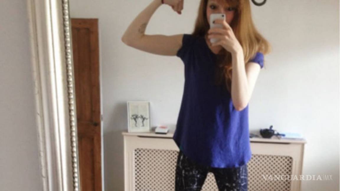 $!Esta carta le salvó la vida a una chica con anorexia