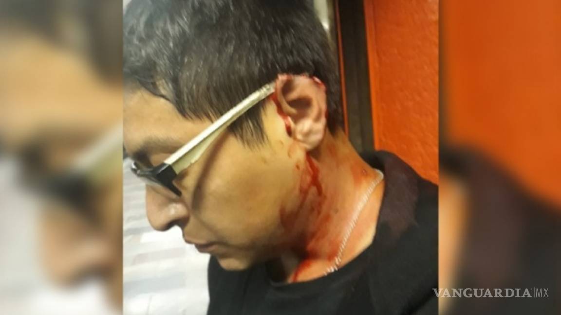 Le arrancan un pedazo de oreja durante una riña en Bellas Artes