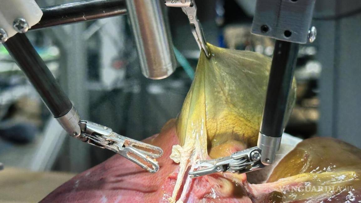 $!Si bien el l robot SRT-H tardó más en la operación que un cirujano humano, los resultados obtenidos por el robot fueron comparables a los de un experto.