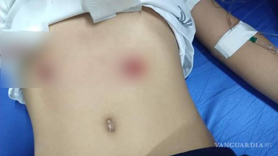 $!Niño ataca a compañeros en Torreón Coahuila; asesina a maestra y se suicida, menor de 7 grave (video)