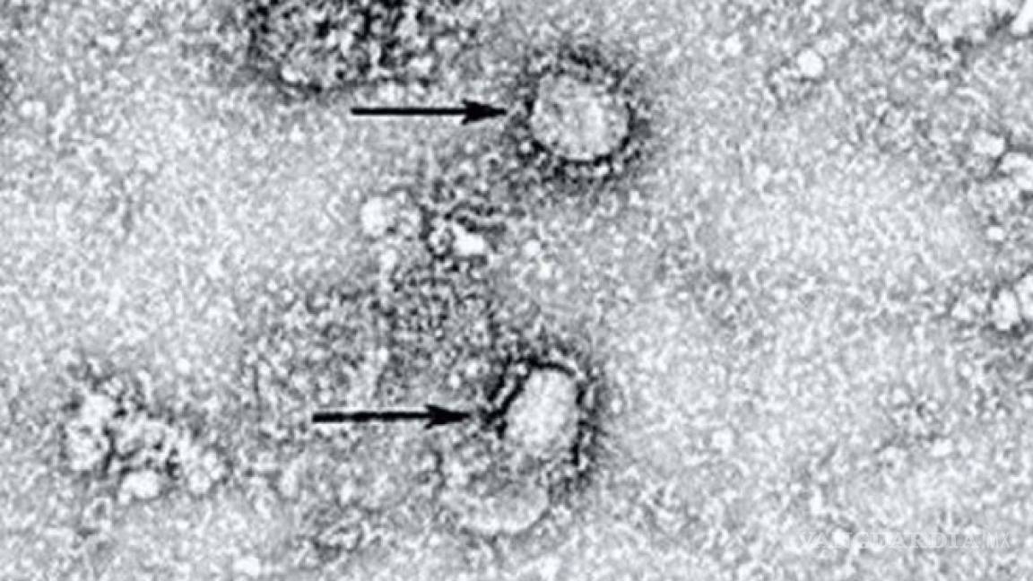 Comparten primera imagen del coronavirus visto desde el microscopio