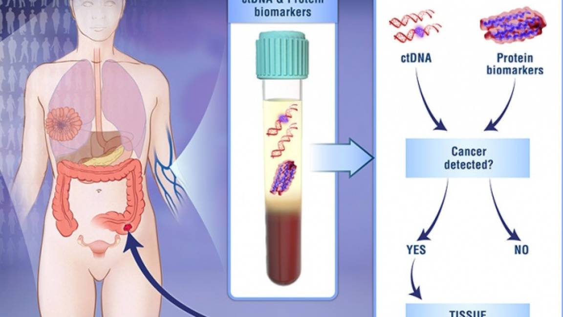 Crean test de sangre que detecta 8 tipos de cáncer