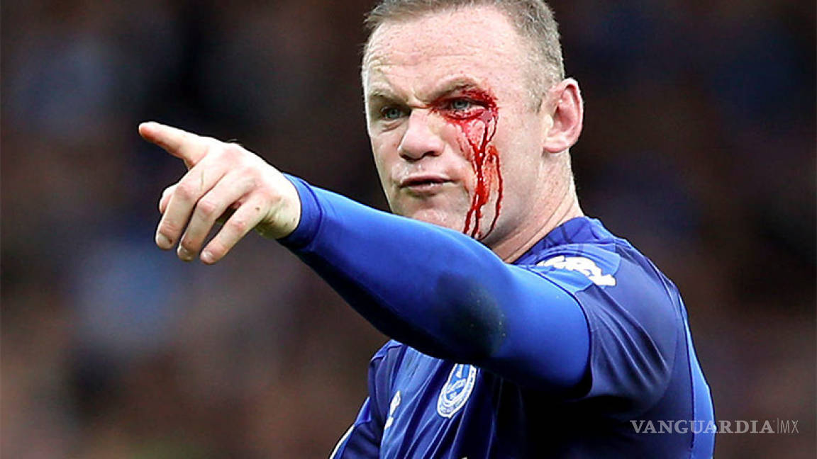 Rooney recibe un brutal codazo en el rostro